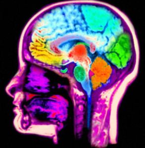 Magnetic resonance scan MRI of the head computer enhanced and colorized to show the normal anatomy of the brain and head